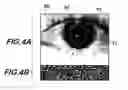 Fig. 05 - Method for performing a procedure according to a biometric image