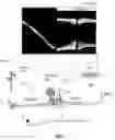 Fig. 01 - Method and system for enhancing accuracy in ultrasonic alignment