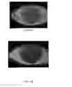 Fig. 05 - Method and apparatus for ocular surface imaging