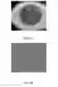 Fig. 06 - Method and apparatus for ocular surface imaging