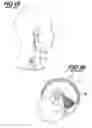 Fig. 02 - NON-INVASIVE INTRACRANIAL PRESSURE SENSOR
