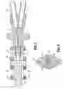 Fig. 03 - Catheter system with attachable catheter hub