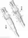Fig. 17 - Catheter system with attachable catheter hub