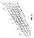 Fig. 20 - Catheter system with attachable catheter hub