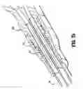 Fig. 22 - Catheter system with attachable catheter hub