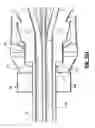 Fig. 26 - Catheter system with attachable catheter hub