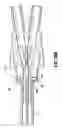 Fig. 27 - Catheter system with attachable catheter hub
