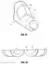 Fig. 31 - Catheter system with attachable catheter hub
