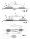 Fig. 02 - Iontophoretic system for transdermal delivery of active agents for therapeutic and medicinal purposes