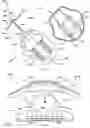 Fig. 03 - System for anchoring medical devices