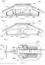 Fig. 04 - System for anchoring medical devices