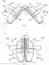 Fig. 05 - System for anchoring medical devices