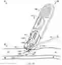 Fig. 08 - System for anchoring medical devices