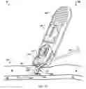Fig. 09 - System for anchoring medical devices