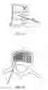 Fig. 02 - Electrosurgical method and apparatus for removing tissue within a bone body