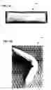 Fig. 02 - Delivery system cartridge