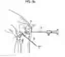 Fig. 08 - System and method for joint resurface repair