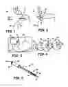 Fig. 02 - METHODS AND DEVICES FOR OCCLUSION OF AN ATRIAL APPENDAGE