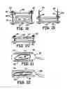 Fig. 07 - METHODS AND DEVICES FOR OCCLUSION OF AN ATRIAL APPENDAGE