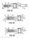 Fig. 22 - METHODS AND DEVICES FOR OCCLUSION OF AN ATRIAL APPENDAGE