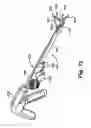 Fig. 33 - METHODS AND DEVICES FOR OCCLUSION OF AN ATRIAL APPENDAGE