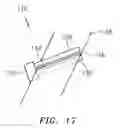 Fig. 09 - Extraluminal sealant applicator and method