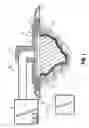Fig. 02 - Negative Pressure and Electrostimulation Therapy Apparatus
