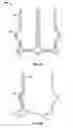 Fig. 04 - Two-stage collapsible/expandable prosthetic heart valves and anchoring systems