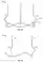 Fig. 07 - Two-stage collapsible/expandable prosthetic heart valves and anchoring systems