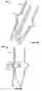 Fig. 09 - Two-stage collapsible/expandable prosthetic heart valves and anchoring systems