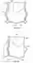 Fig. 22 - Two-stage collapsible/expandable prosthetic heart valves and anchoring systems