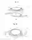 Fig. 02 - Accommodative intraocular lens system