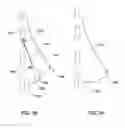 Fig. 06 - SYSTEM FOR LIFTING AND RESHAPING SOFT TISSUE