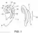 Fig. 02 - Ear molding device for correcting misshaped ears