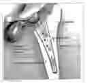 Fig. 01 - MEDICAL DEVICE