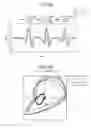 Fig. 15 - Gesture recognition apparatus, gesture recognition method and program
