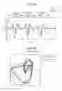 Fig. 16 - Gesture recognition apparatus, gesture recognition method and program
