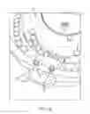 Fig. 07 - Automatic pill dispensing device and method of use thereof