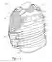 Fig. 02 - Releasable vest