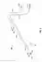 Fig. 05 - Two piece tube for suction coagulator