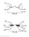 Fig. 06 - Thick Conductor