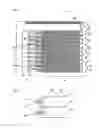 Fig. 02 - MICROMECHANICAL COMPONENT AND METHOD FOR OPERATING A MICROMECHANICAL COMPONENT