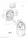 Fig. 06 - RETRACTABLE CARRYING DEVICE FOR AN OPTICAL DEVICE