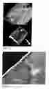 Fig. 07 - COATED DIAMOND