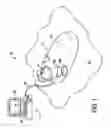 Fig. 02 - Haptic trackball device