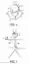 Fig. 02 - Assistance system for visually handicapped persons