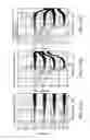 Fig. 14 - Auditory sense correction device
