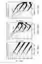 Fig. 15 - Auditory sense correction device