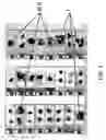 Fig. 06 - METHOD AND DEVICE FOR AUTOMATICALLY ANALYZING BIOLOGICAL SAMPLES