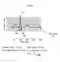 Fig. 06 - Respiratory motion compensated cardiac wall motion determination system